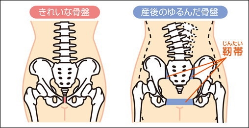 出産後の骨盤はダメージを受けて緩んでしまっている。